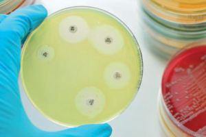 Impactos sanitarios y económicos de la resistencia a los antimicrobianos en humanos y animales productores de alimentos