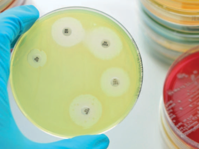 Impactos sanitarios y económicos de la resistencia a los antimicrobianos en humanos y animales productores de alimentos