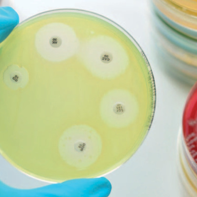 Impactos sanitarios y económicos de la resistencia a los antimicrobianos en humanos y animales productores de alimentos