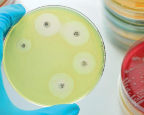 Impactos sanitarios y económicos de la resistencia a los antimicrobianos en humanos y animales productores de alimentos